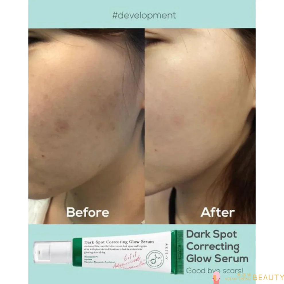 AXIS-Y Dark Spot Correcting Glow Serum – Best Korean Skincare for Hyperpigmentation & Dark Spots in Pakistan