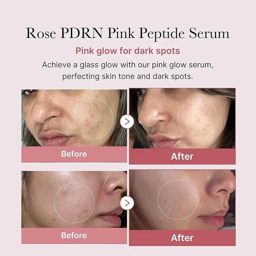 Medicube PDRN Pink Peptide Serum 30ml – Anti-Aging & Repair